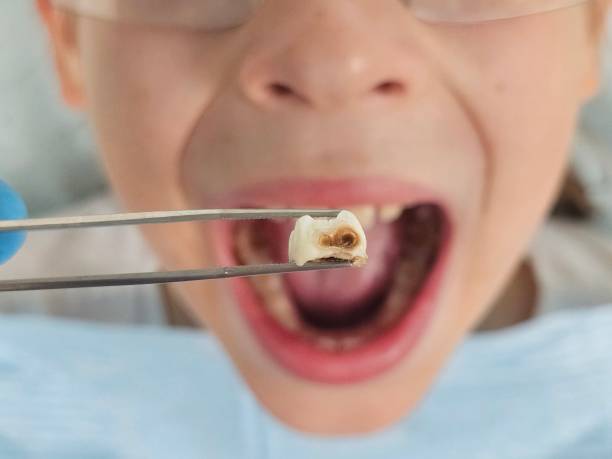 Best Broken Tooth Emergency  in Lewisburg, KY